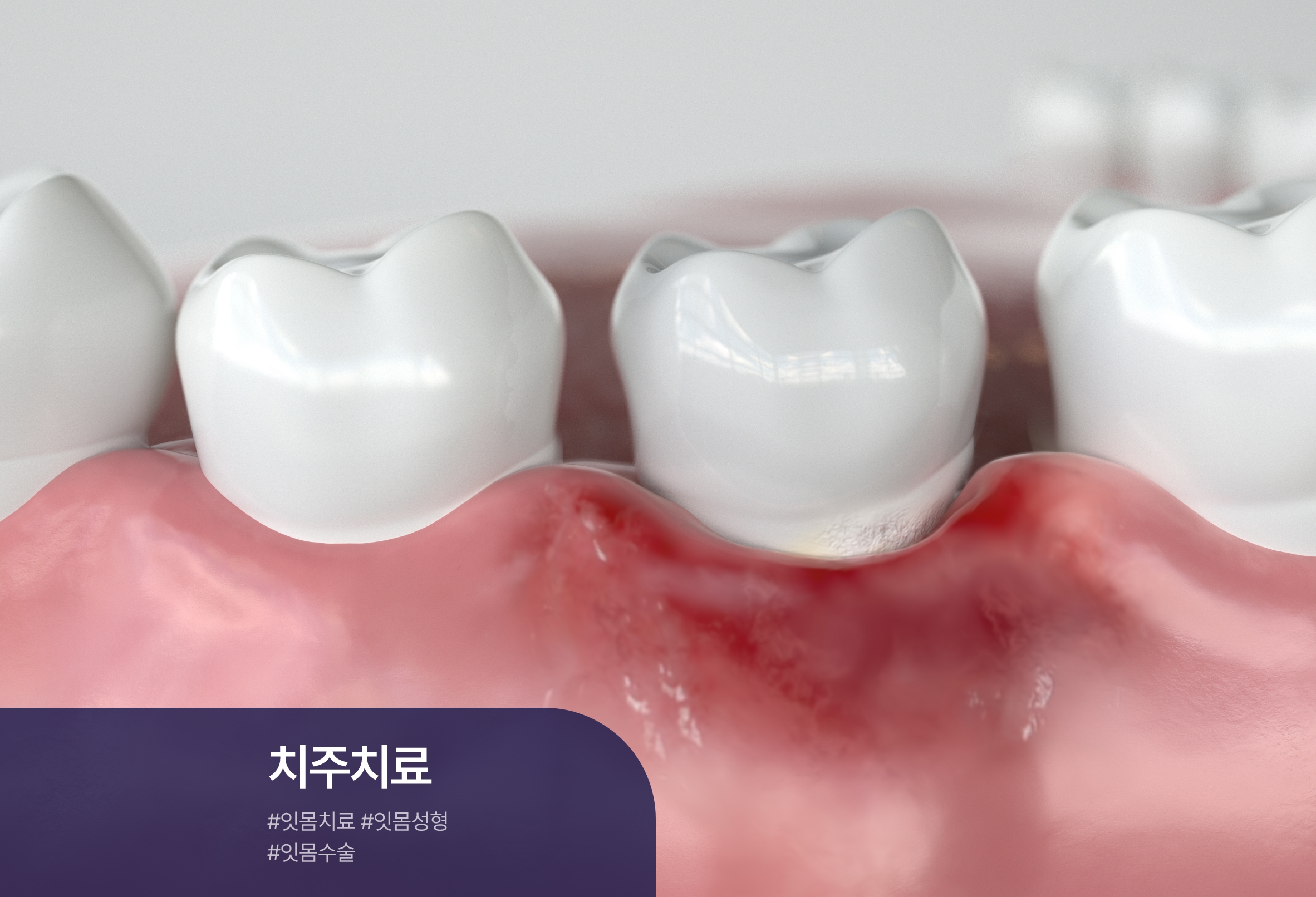 클릭이미지