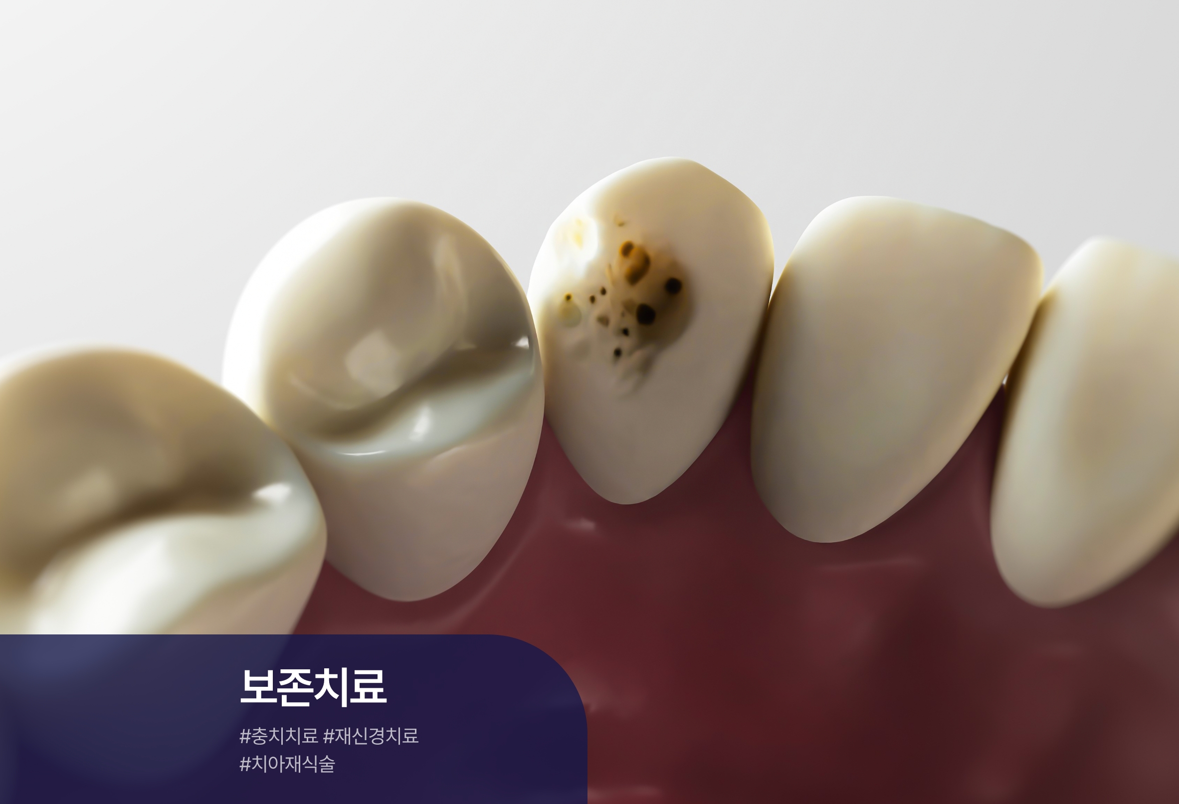 클릭이미지