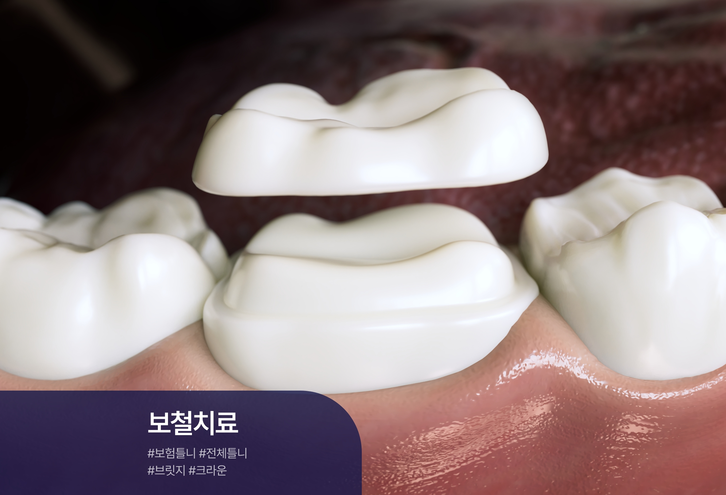 클릭이미지