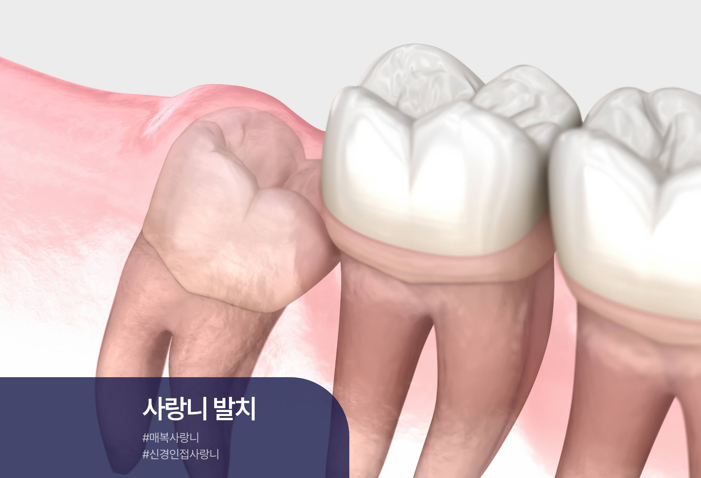 클릭이미지