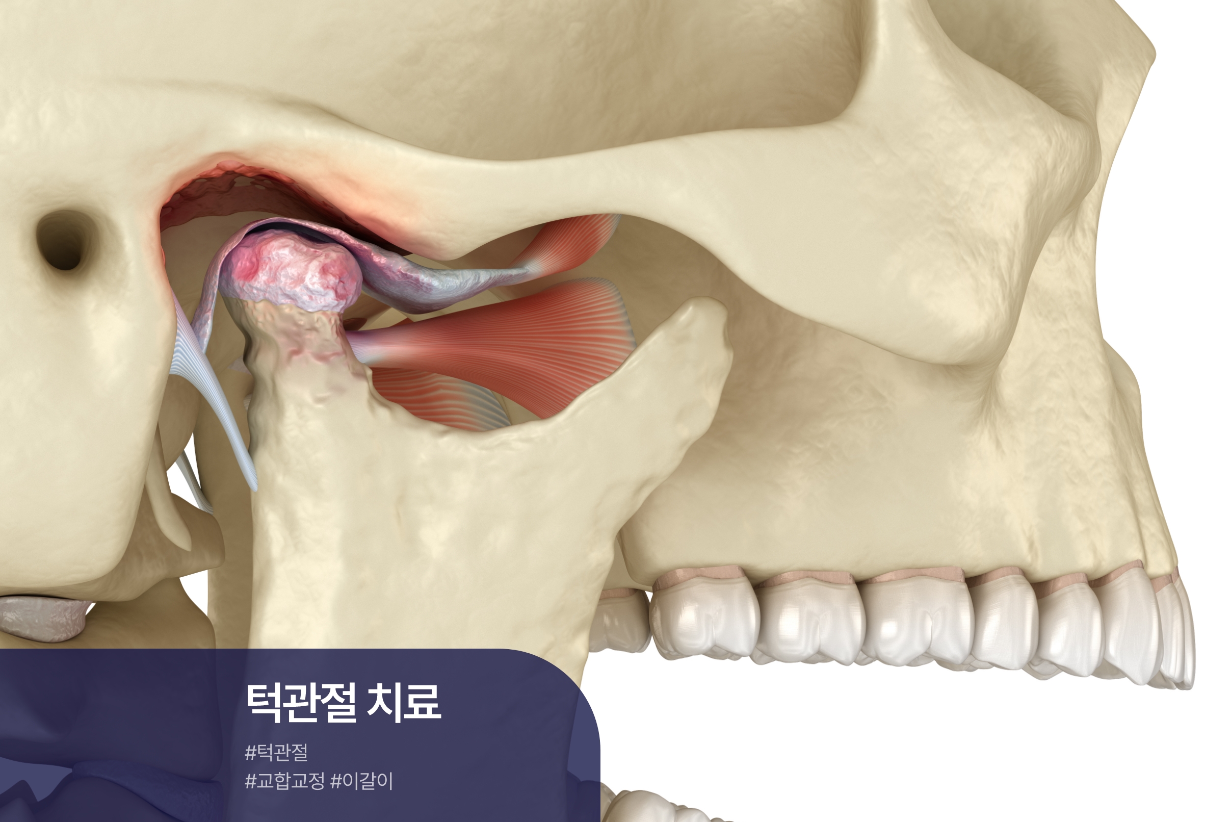 클릭이미지